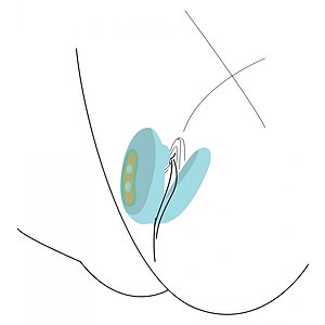 Couples Foreplay Enhancer Turcoaz