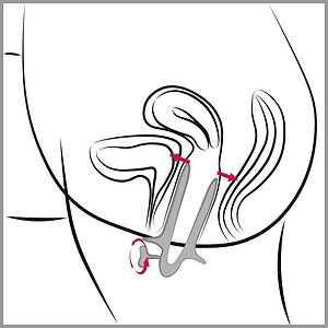Genital Speculum Argintiu