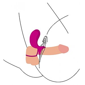 Inel Dublă Stimulare Couples Stimulator Ring Fuchsia