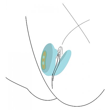 Couples Foreplay Enhancer Turcoaz